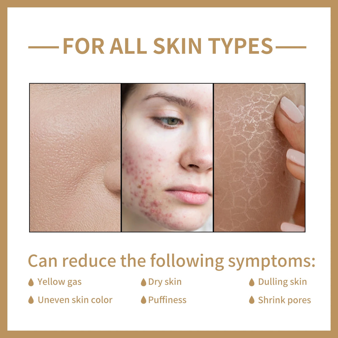 Rice Face Toner Moisturizing Smoothness Barrier Care Antioxidant