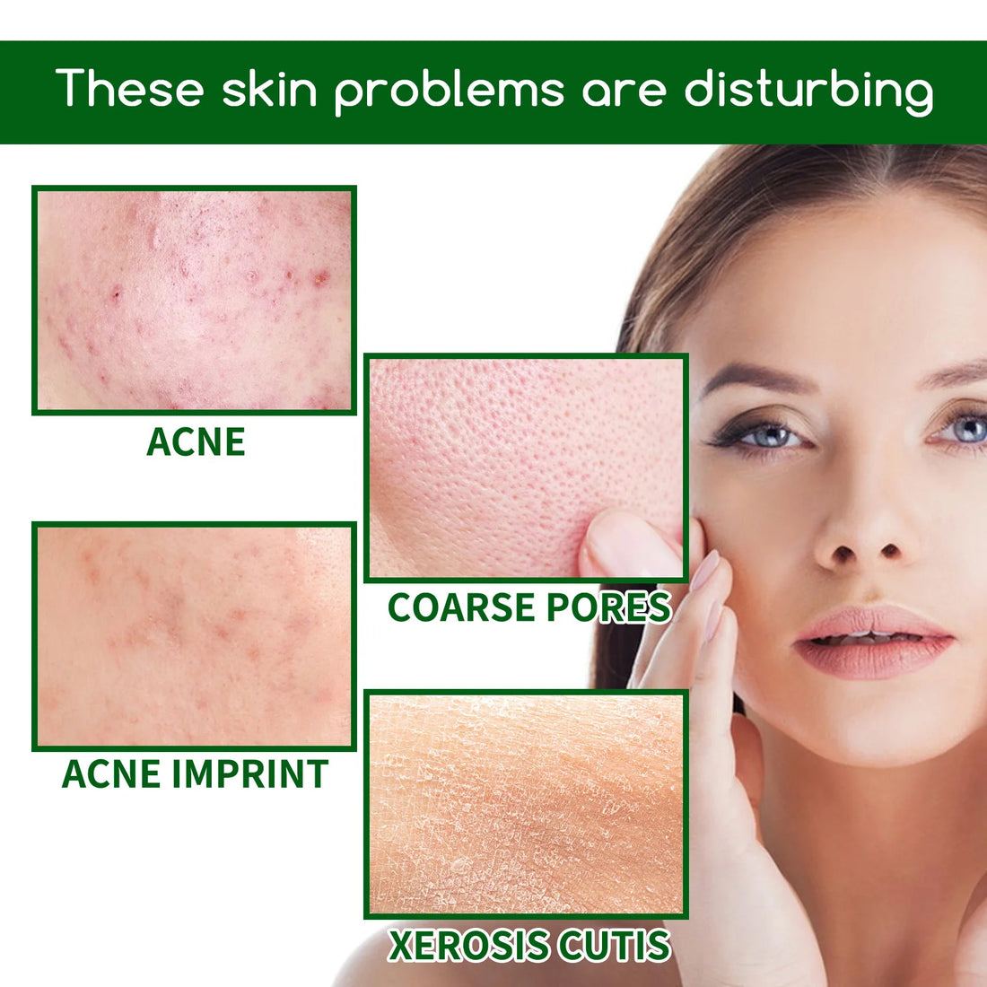 Salicylic Acid Facial Serum Acne Mark Pore Oil Control
