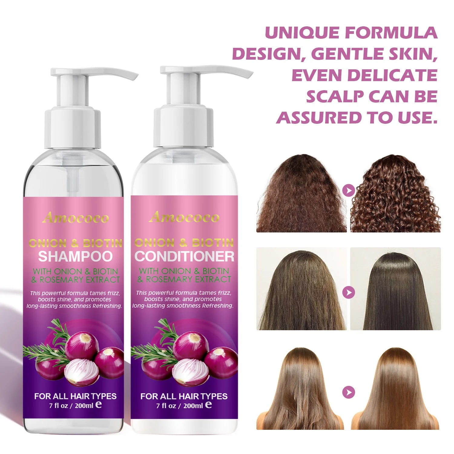 Amococo Onion Biotin Rosemary Shampoo Conditioner Hair Care Set
